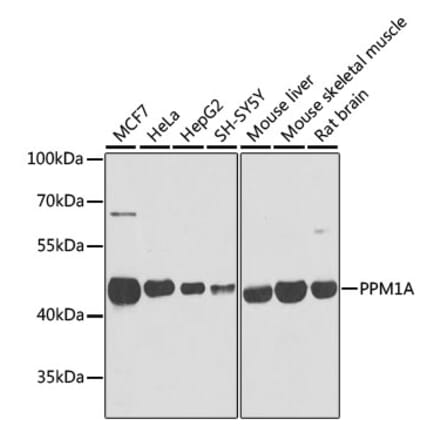 Western Blot - Anti-PPM1A Antibody (A15333) - Antibodies.com