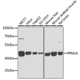 Western Blot - Anti-PPM1A Antibody (A15333) - Antibodies.com