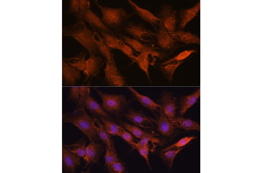 Immunofluorescence - Anti-PPM1A Antibody (A15333) - Antibodies.com
