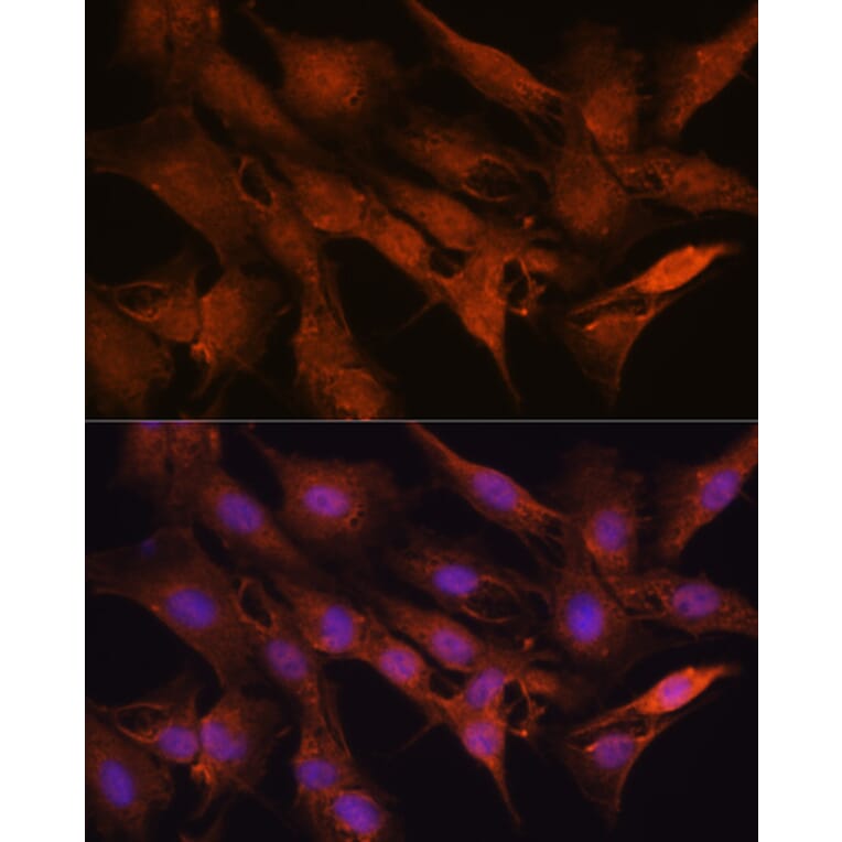 Immunofluorescence - Anti-PPM1A Antibody (A15333) - Antibodies.com