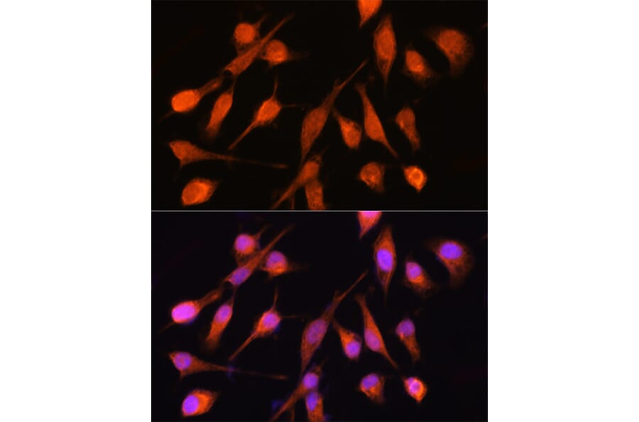 Immunofluorescence - Anti-PPM1A Antibody (A15333) - Antibodies.com