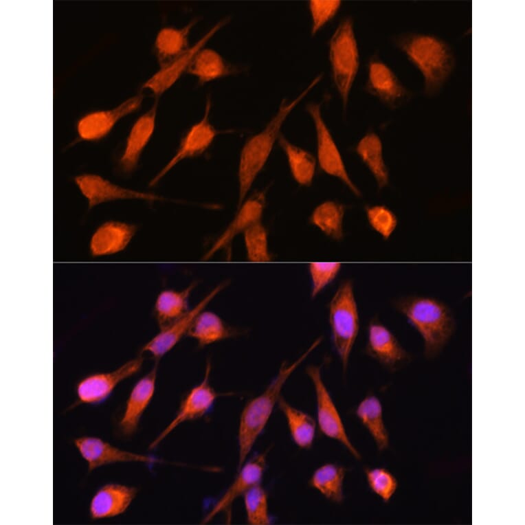 Immunofluorescence - Anti-PPM1A Antibody (A15333) - Antibodies.com