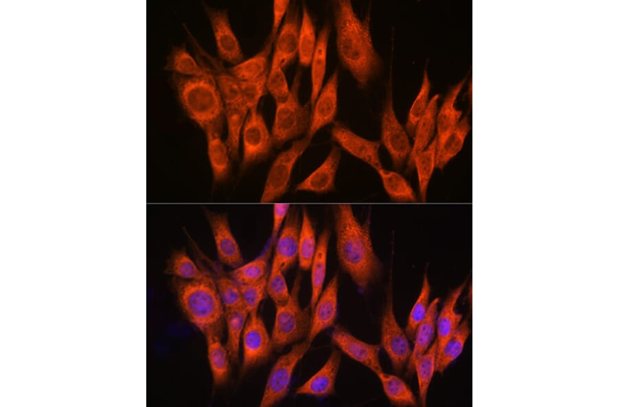 Immunofluorescence - Anti-PPM1A Antibody (A15333) - Antibodies.com