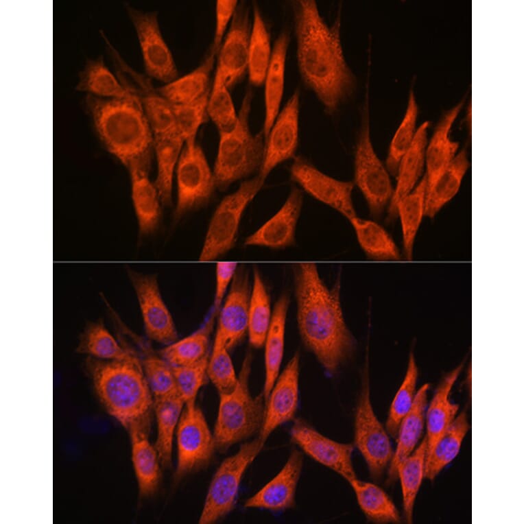 Immunofluorescence - Anti-PPM1A Antibody (A15333) - Antibodies.com