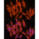 Immunofluorescence - Anti-PPM1A Antibody (A15333) - Antibodies.com