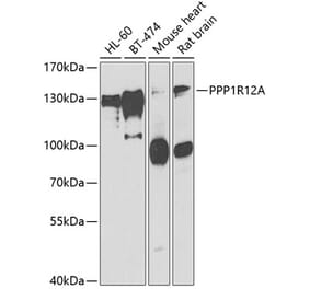Western Blot - Anti-Myosin Phosphatase Antibody (A15334) - Antibodies.com