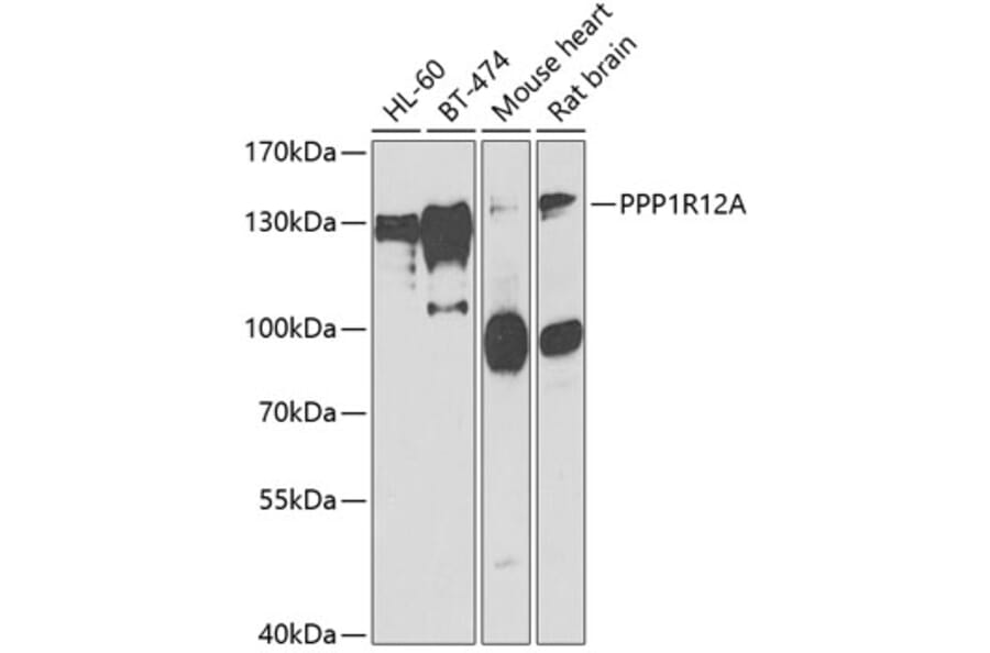 Western Blot - Anti-Myosin Phosphatase Antibody (A15334) - Antibodies.com