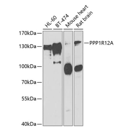 Western Blot - Anti-Myosin Phosphatase Antibody (A15334) - Antibodies.com