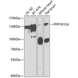 Western Blot - Anti-Myosin Phosphatase Antibody (A15334) - Antibodies.com