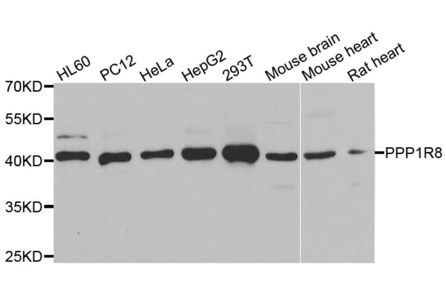 Western Blot - Anti-PPP1R8 Antibody (A6701) - Antibodies.com