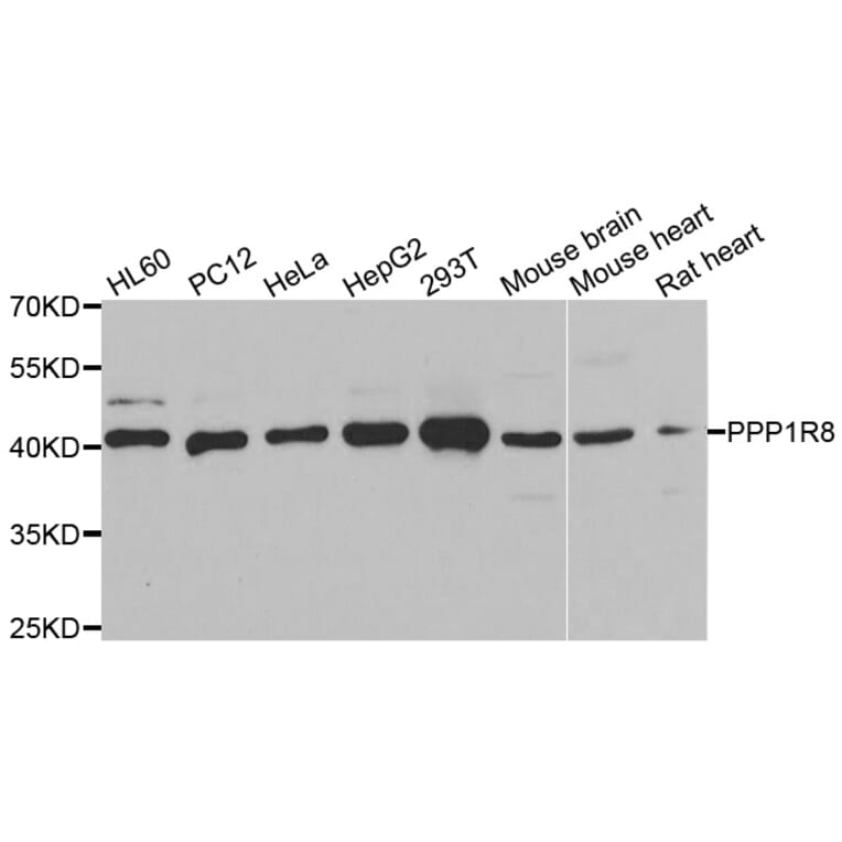 Western Blot - Anti-PPP1R8 Antibody (A6701) - Antibodies.com