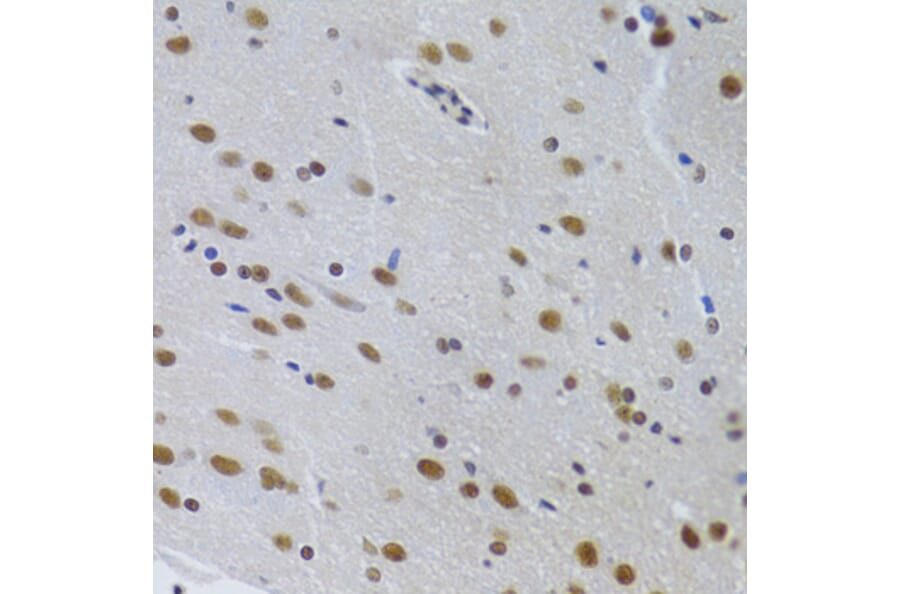 Immunohistochemistry - Anti-PPP1R8 Antibody (A6701) - Antibodies.com