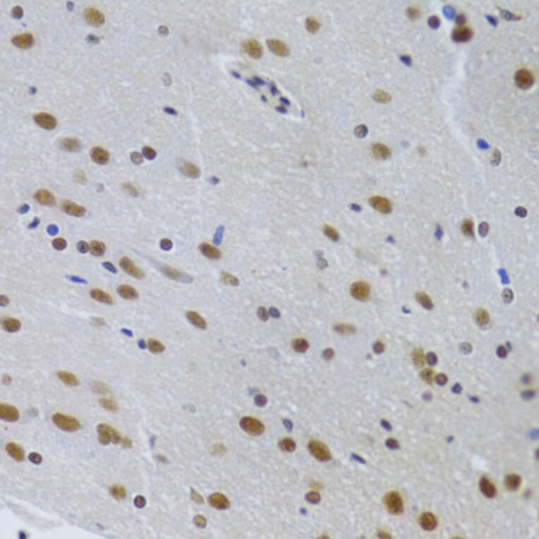 Immunohistochemistry - Anti-PPP1R8 Antibody (A6701) - Antibodies.com