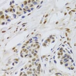 Immunohistochemistry - Anti-PPP1R8 Antibody (A6701) - Antibodies.com