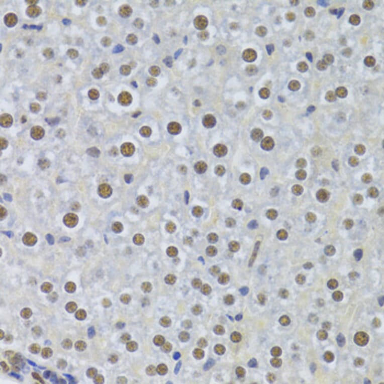 Immunohistochemistry - Anti-PPP1R8 Antibody (A6701) - Antibodies.com
