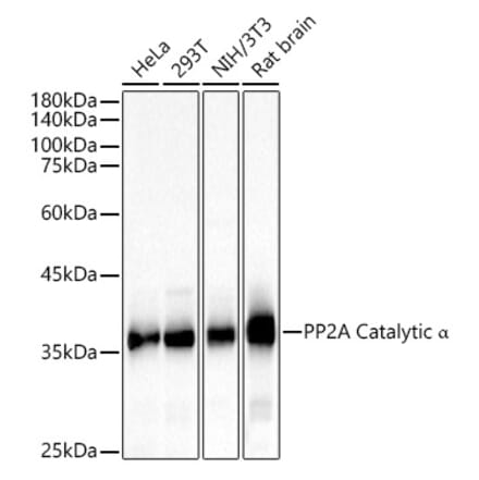 Western Blot - Anti-PP2A-alpha Antibody (A15336) - Antibodies.com