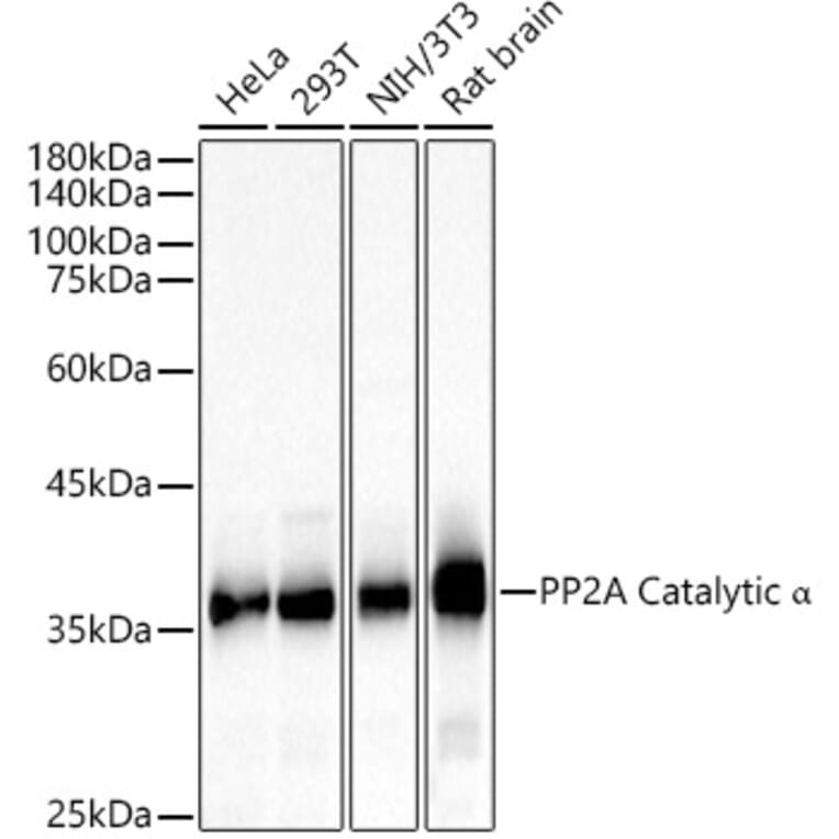 Western Blot - Anti-PP2A-alpha Antibody (A15336) - Antibodies.com