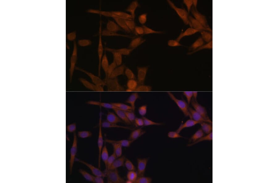 Immunofluorescence - Anti-PP2A-alpha Antibody (A15336) - Antibodies.com