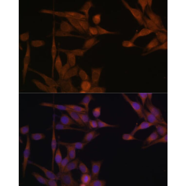 Immunofluorescence - Anti-PP2A-alpha Antibody (A15336) - Antibodies.com