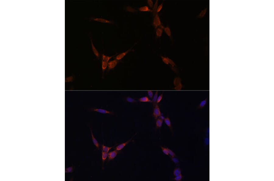 Immunofluorescence - Anti-PP2A-alpha Antibody (A15336) - Antibodies.com