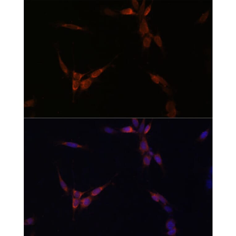 Immunofluorescence - Anti-PP2A-alpha Antibody (A15336) - Antibodies.com