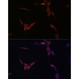 Immunofluorescence - Anti-PP2A-alpha Antibody (A15336) - Antibodies.com