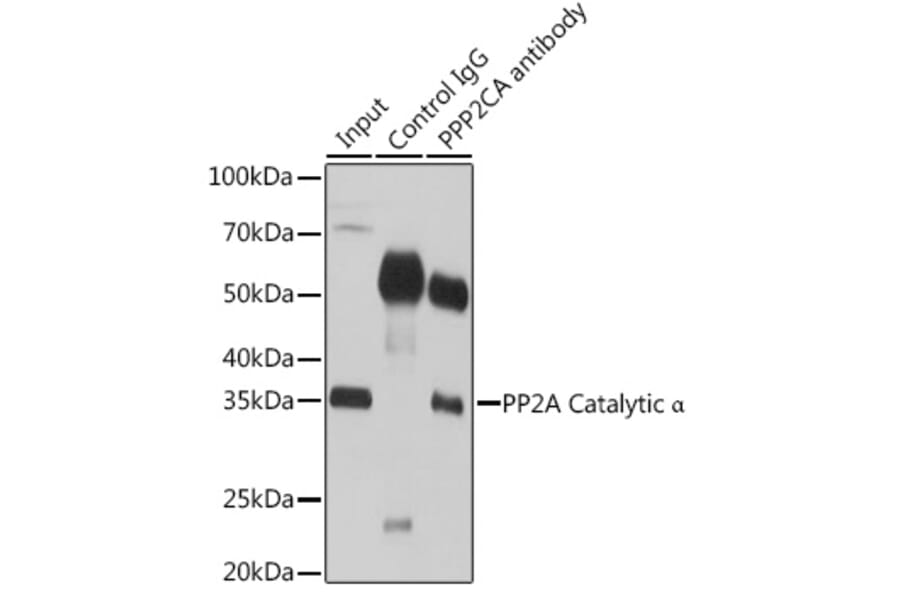 Western Blot - Anti-PP2A-alpha Antibody (A15336) - Antibodies.com
