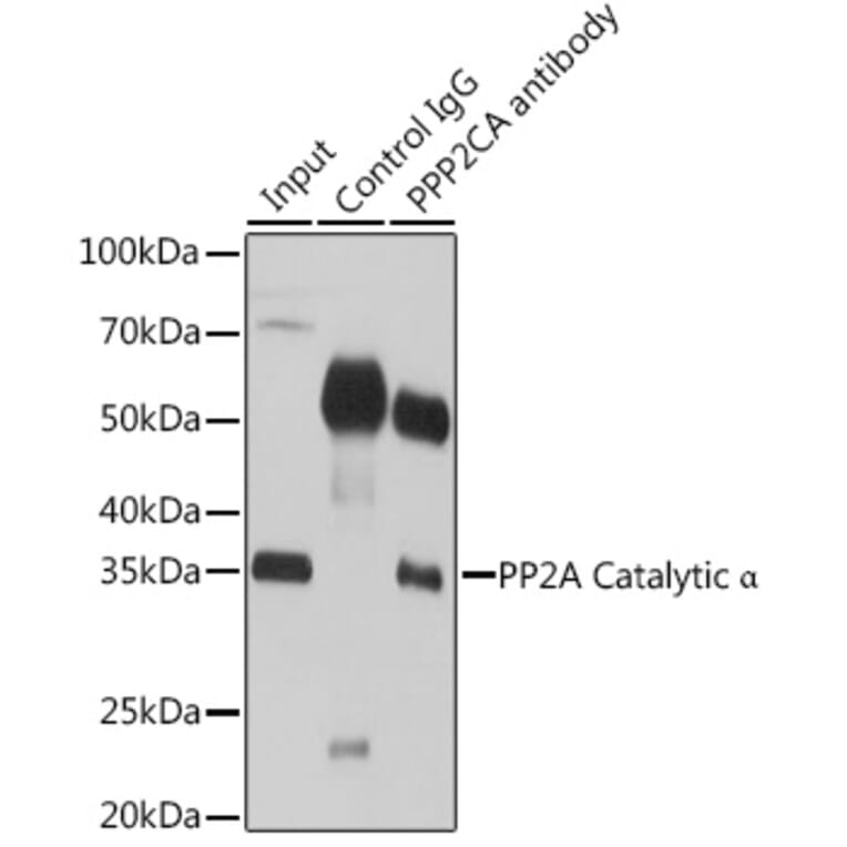 Western Blot - Anti-PP2A-alpha Antibody (A15336) - Antibodies.com