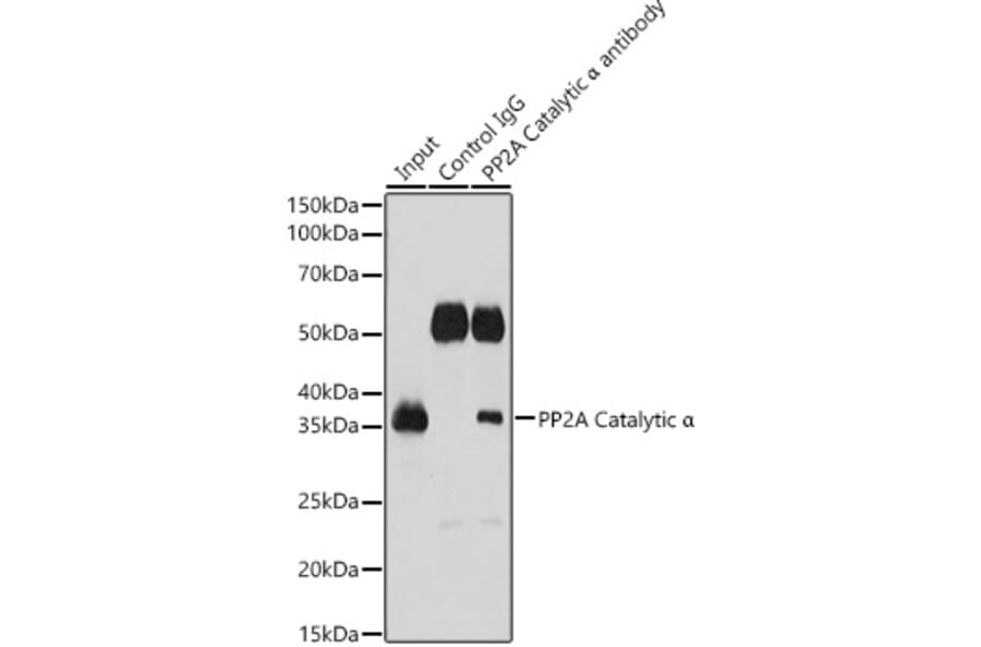 Western Blot - Anti-PP2A-alpha Antibody (A15336) - Antibodies.com