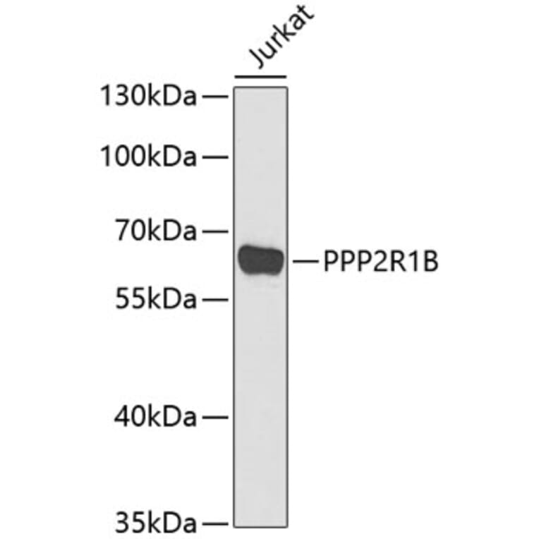 Western Blot - Anti-PPP2R1B Antibody (A6703) - Antibodies.com