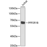 Western Blot - Anti-PPP2R1B Antibody (A6703) - Antibodies.com