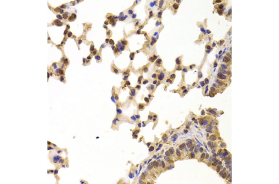 Immunohistochemistry - Anti-PPP2R1B Antibody (A6703) - Antibodies.com