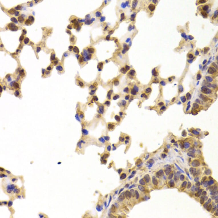 Immunohistochemistry - Anti-PPP2R1B Antibody (A6703) - Antibodies.com