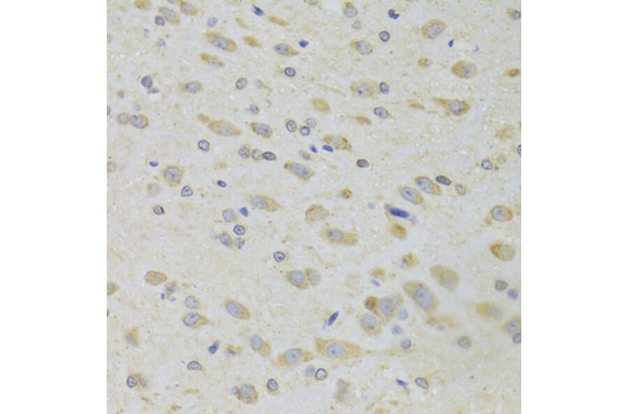 Immunohistochemistry - Anti-PPP2R1B Antibody (A6703) - Antibodies.com
