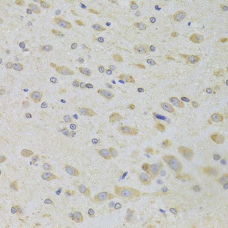 Immunohistochemistry - Anti-PPP2R1B Antibody (A6703) - Antibodies.com