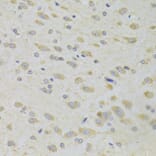 Immunohistochemistry - Anti-PPP2R1B Antibody (A6703) - Antibodies.com
