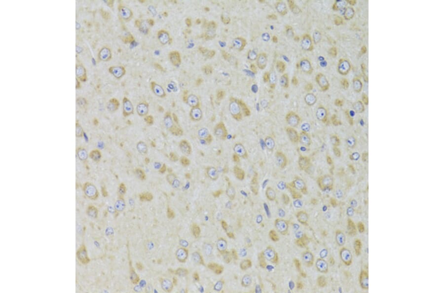 Immunohistochemistry - Anti-PPP2R1B Antibody (A6703) - Antibodies.com