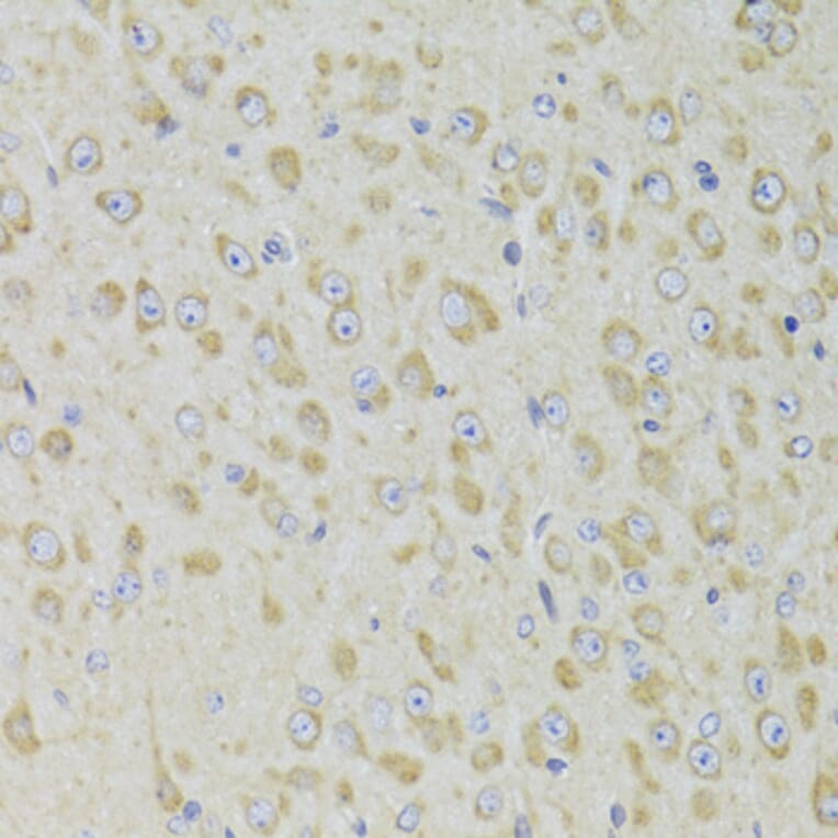 Immunohistochemistry - Anti-PPP2R1B Antibody (A6703) - Antibodies.com
