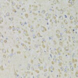 Immunohistochemistry - Anti-PPP2R1B Antibody (A6703) - Antibodies.com