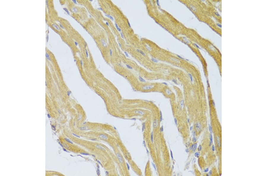 Immunohistochemistry - Anti-PPP2R1B Antibody (A6703) - Antibodies.com