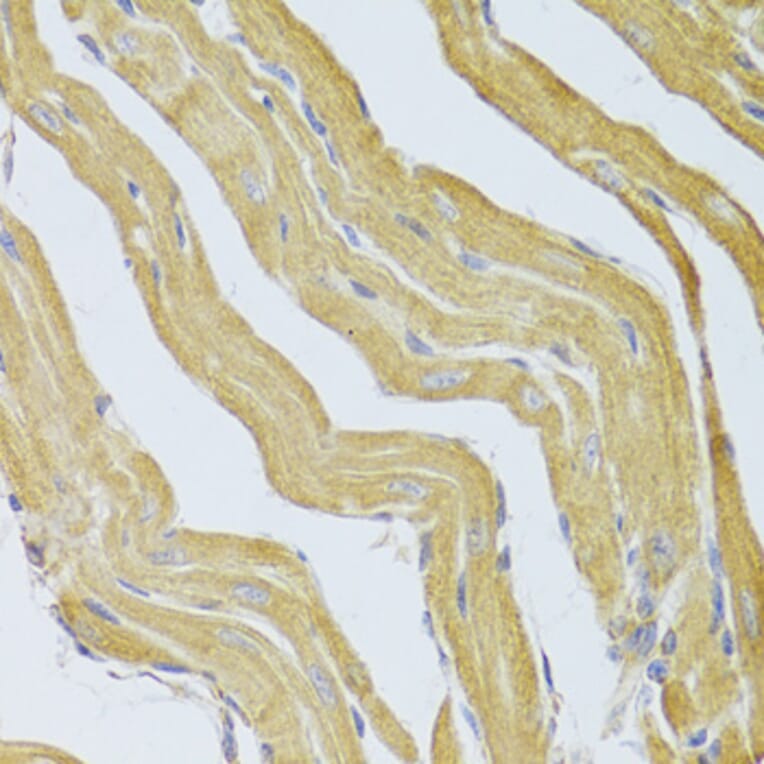 Immunohistochemistry - Anti-PPP2R1B Antibody (A6703) - Antibodies.com