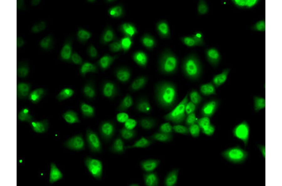 Immunofluorescence - Anti-PPP2R1B Antibody (A6703) - Antibodies.com