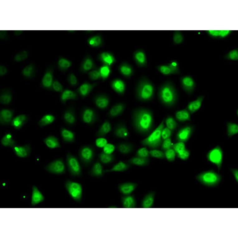 Immunofluorescence - Anti-PPP2R1B Antibody (A6703) - Antibodies.com