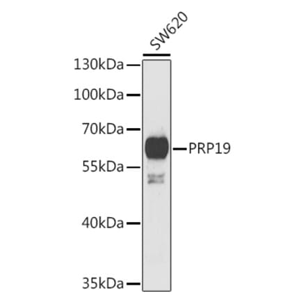 Western Blot - Anti-PRP19 Antibody (A15338) - Antibodies.com