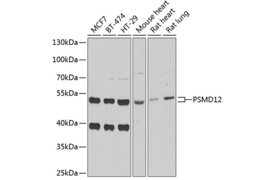 Western Blot - Anti-PSMD12 Antibody (A15339) - Antibodies.com
