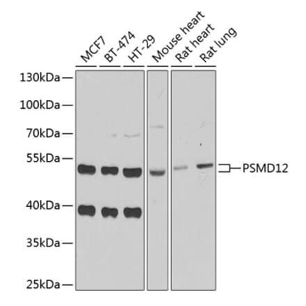 Western Blot - Anti-PSMD12 Antibody (A15339) - Antibodies.com