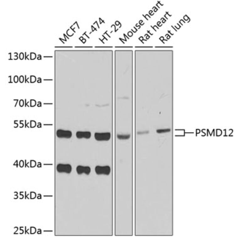 Western Blot - Anti-PSMD12 Antibody (A15339) - Antibodies.com