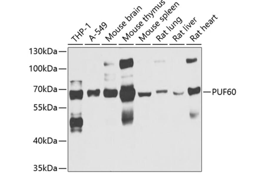 Western Blot - Anti-PUF60/FIR Antibody (A15340) - Antibodies.com