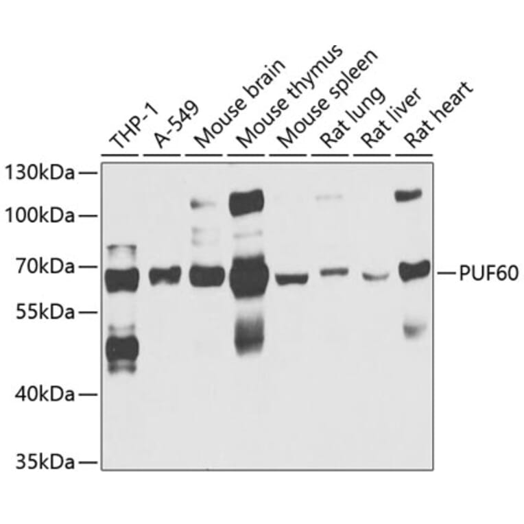 Western Blot - Anti-PUF60/FIR Antibody (A15340) - Antibodies.com