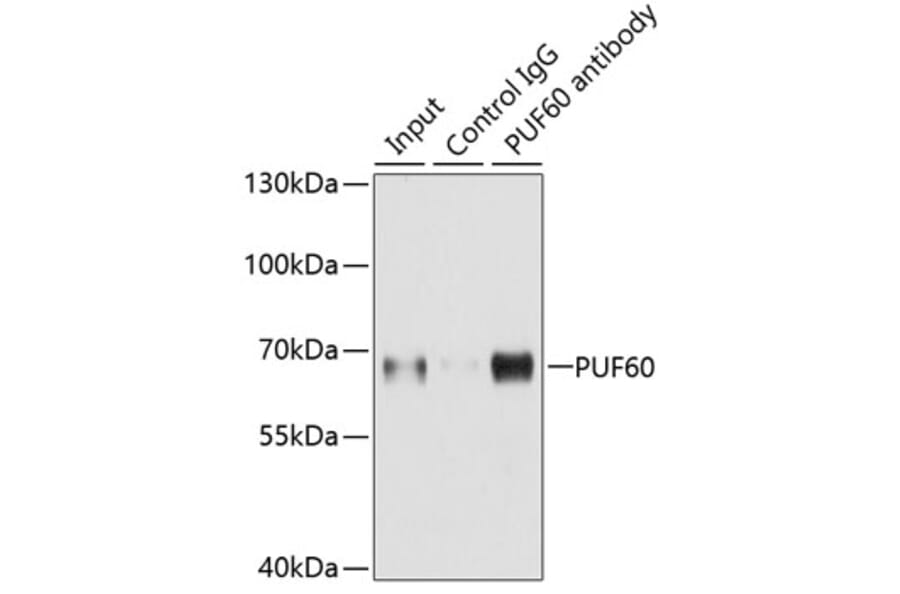 Western Blot - Anti-PUF60/FIR Antibody (A15340) - Antibodies.com